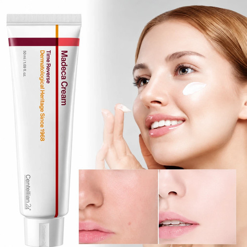 Centellian24 madeca cream - cream, time
